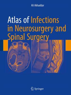 Atlas of Infections in Neurosurgery and Spinal Surgery de Ali Akhaddar