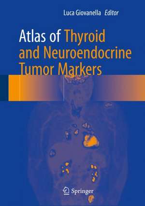 Atlas of Thyroid and Neuroendocrine Tumor Markers de Luca Giovanella