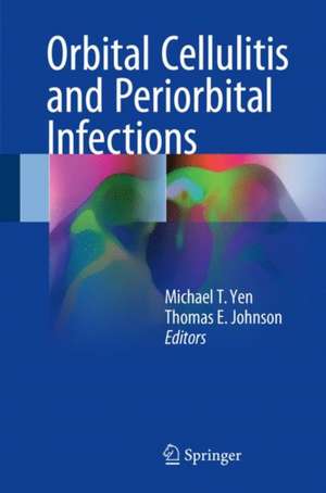 Orbital Cellulitis and Periorbital Infections de Michael T. Yen