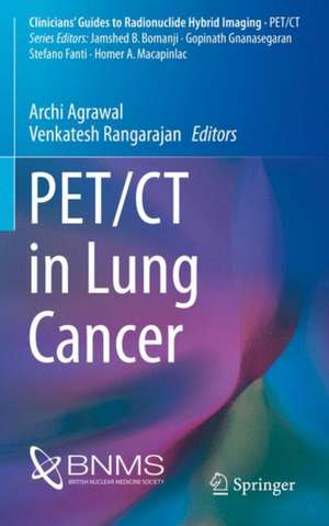 PET/CT in Lung Cancer de Archi Agrawal