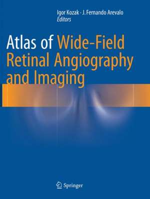 Atlas of Wide-Field Retinal Angiography and Imaging de Igor Kozak