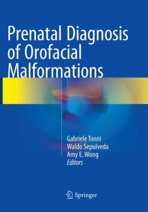 Prenatal Diagnosis of Orofacial Malformations de Gabriele Tonni