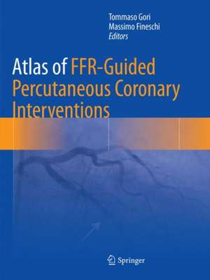 Atlas of FFR-Guided Percutaneous Coronary Interventions de Tommaso Gori