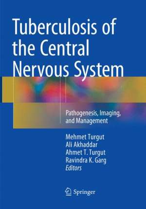 Tuberculosis of the Central Nervous System: Pathogenesis, Imaging, and Management de Mehmet Turgut