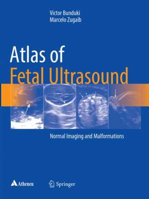 Atlas of Fetal Ultrasound: Normal Imaging and Malformations de Victor Bunduki