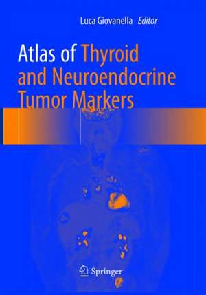 Atlas of Thyroid and Neuroendocrine Tumor Markers de Luca Giovanella