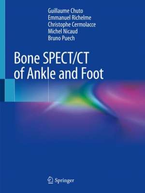 Bone SPECT/CT of Ankle and Foot de Guillaume Chuto