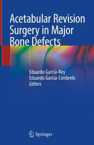 Acetabular Revision Surgery in Major Bone Defects de Eduardo García-Rey