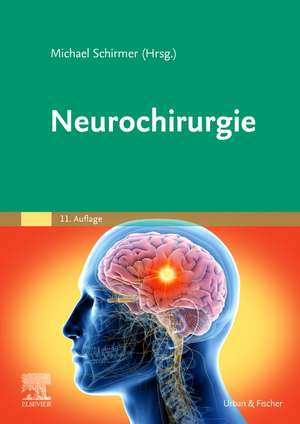 Neurochirurgie de Michael Schirmer