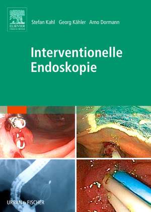 Interventionelle Endoskopie de Arno J. Dormann