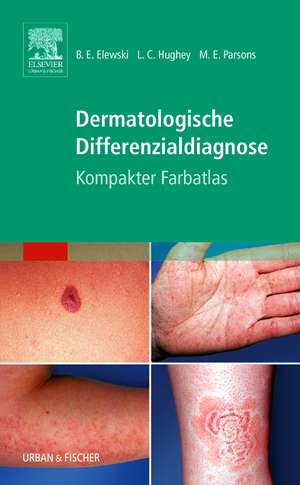 Dermatologische Differenzialdiagnose de Boni E. Elewski