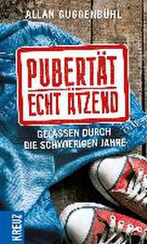 Pubertät - echt ätzend de Allan Guggenbühl