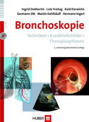 Bronchoskopie de Ingrid Dobbertin