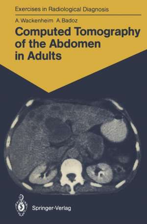 Computed Tomography of the Abdomen in Adults: 85 Radiological Exercises for Students and Practitioners de Auguste Wackenheim