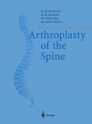 Arthroplasty of the Spine de Robert Gunzburg