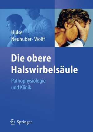 Die obere Halswirbelsäule: Pathophysiologie und Klinik de Manfred Hülse