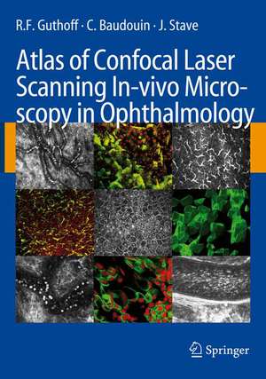 Atlas of Confocal Laser Scanning In-vivo Microscopy in Ophthalmology de R.F. Guthoff