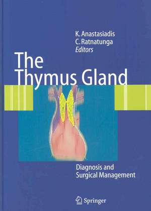 The Thymus Gland: Diagnosis and Surgical Management de Kyriakos Anastasiadis