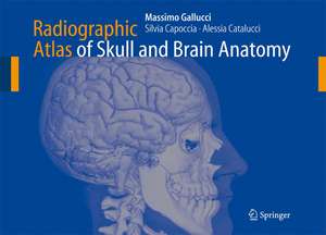 Radiographic Atlas of Skull and Brain Anatomy de Massimo Gallucci