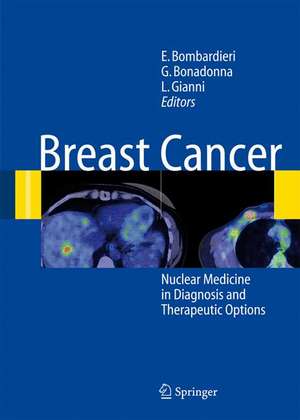 Breast Cancer: Nuclear Medicine in Diagnosis and Therapeutic Options de Emilio Bombardieri