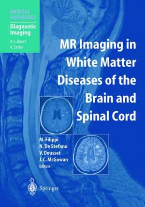 MR Imaging in White Matter Diseases of the Brain and Spinal Cord de Massimo Filippi