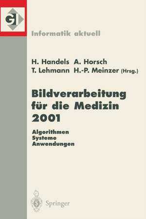 Bildverarbeitung für die Medizin 2001: Algorithmen — Systeme — Anwendungen de Heinz Handels