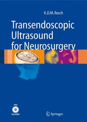 Transendoscopic Ultrasound for Neurosurgery de Klaus Dieter Maria Resch