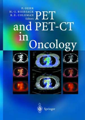 PET and PET-CT in Oncology de Peter Oehr