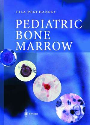 Pediatric Bone Marrow de Lila Penchansky