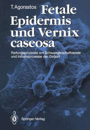 Fetale Epidermis und Vernix caseosa: Reifungsprozesse am Schwangerschaftsende und Initiativprozesse der Geburt de Theodoros Agorastos