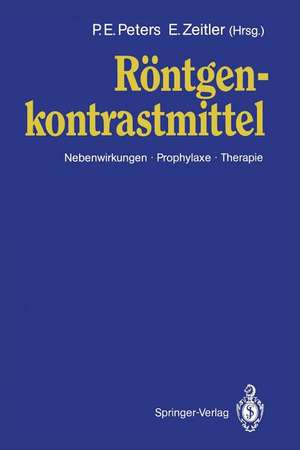 Röntgen kontrastmittel: Nebenwirkungen · Prophylaxe · Therapie de P. E. Peters