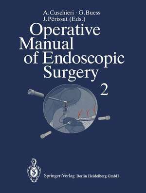 Operative Manual of Endoscopic Surgery 2