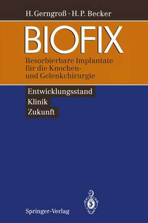 BIOFIX: Resorbierbare Implantate für die Knochen- und Gelenkchirurgie — Entwicklungsstand, Klinik, Zukunft — de Heinz Gerngroß