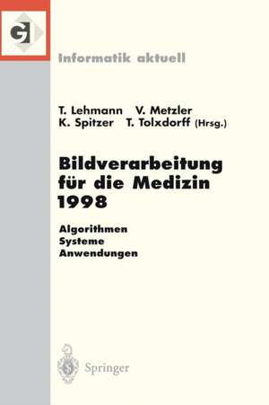 Bildverarbeitung für die Medizin 1998: Algorithmen — Systeme — Anwendungen Proceedings des Workshops am 26. und 27. März 1998 in Aachen de Thomas Lehmann