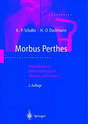 Morbus Perthes