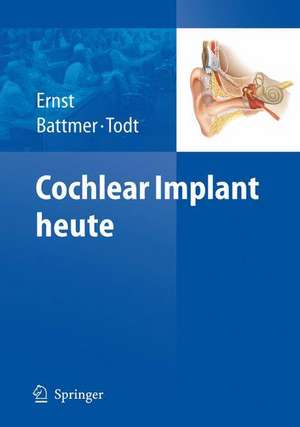 Cochlear Implant heute de Arne Ernst