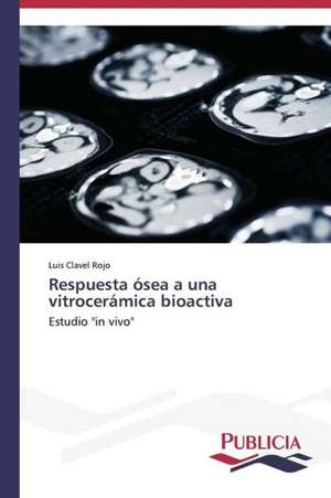 Respuesta Osea a Una Vitroceramica Bioactiva: de La Agricultura Al Turismo de Luis Clavel Rojo