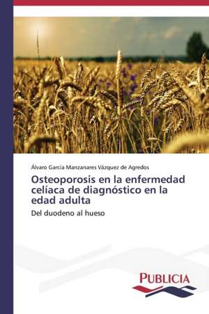 Osteoporosis En La Enfermedad Celiaca de Diagnostico En La Edad Adulta