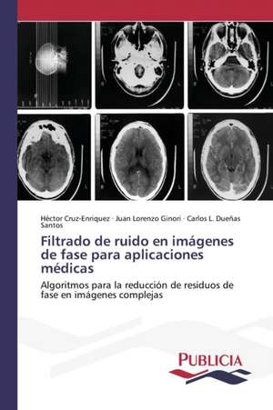 Filtrado de Ruido En Imagenes de Fase Para Aplicaciones Medicas: Literatura Fantastica y Funcion Social En Ricardo Piglia de Héctor Cruz-Enriquez