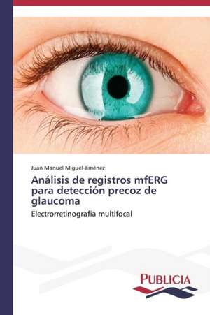 Analisis de Registros Mferg Para Deteccion Precoz de Glaucoma