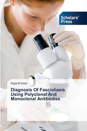 Diagnosis of Fascioliasis Using Polyclonal and Monoclonal Anitbodies: LVL Reinforced Composite de Azza El Amir