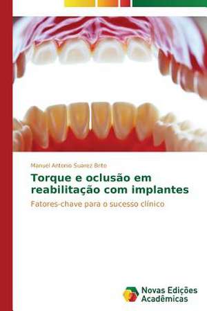 Torque E Oclusao Em Reabilitacao Com Implantes: Rol' Uchitelya de Manuel Antonio Suárez Brito