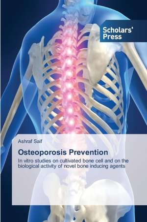 Osteoporosis Prevention de Ashraf Saif