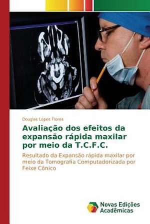 Avaliacao DOS Efeitos Da Expansao Rapida Maxilar Por Meio Da T.C.F.C.: Conhecimento E Atitude DOS Obstetras No Trabalho de Parto de Douglas Lopes Flores