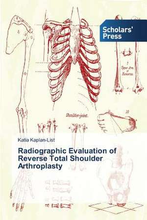 Radiographic Evaluation of Reverse Total Shoulder Arthroplasty de Katia Kaplan-List