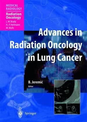 Advances in Radiation Oncology in Lung Cancer de Branislav Jeremic