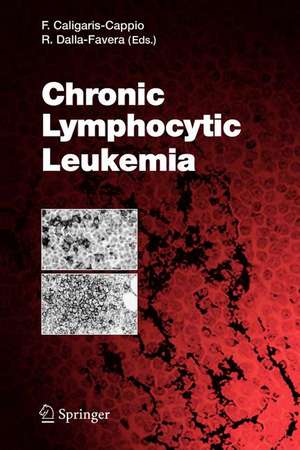 Chronic Lymphocytic Leukemia de Federico Caligaris-Cappio