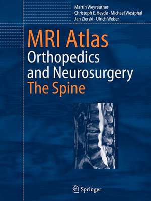 MRI Atlas: Orthopedics and Neurosurgery, The Spine de Martin Weyreuther