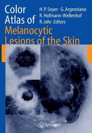 Color Atlas of Melanocytic Lesions of the Skin de H. Peter Soyer