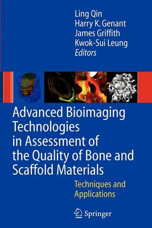 Advanced Bioimaging Technologies in Assessment of the Quality of Bone and Scaffold Materials: Techniques and Applications de L. Qin